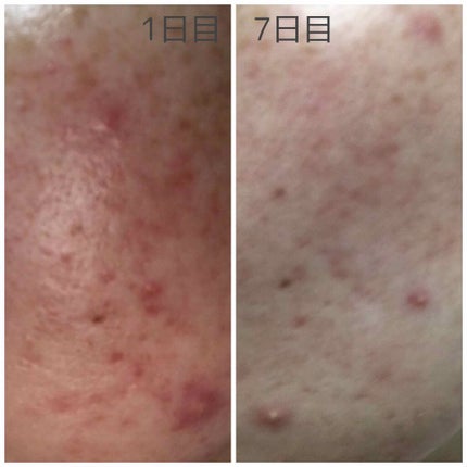 を使ったクチコミ(2枚目)