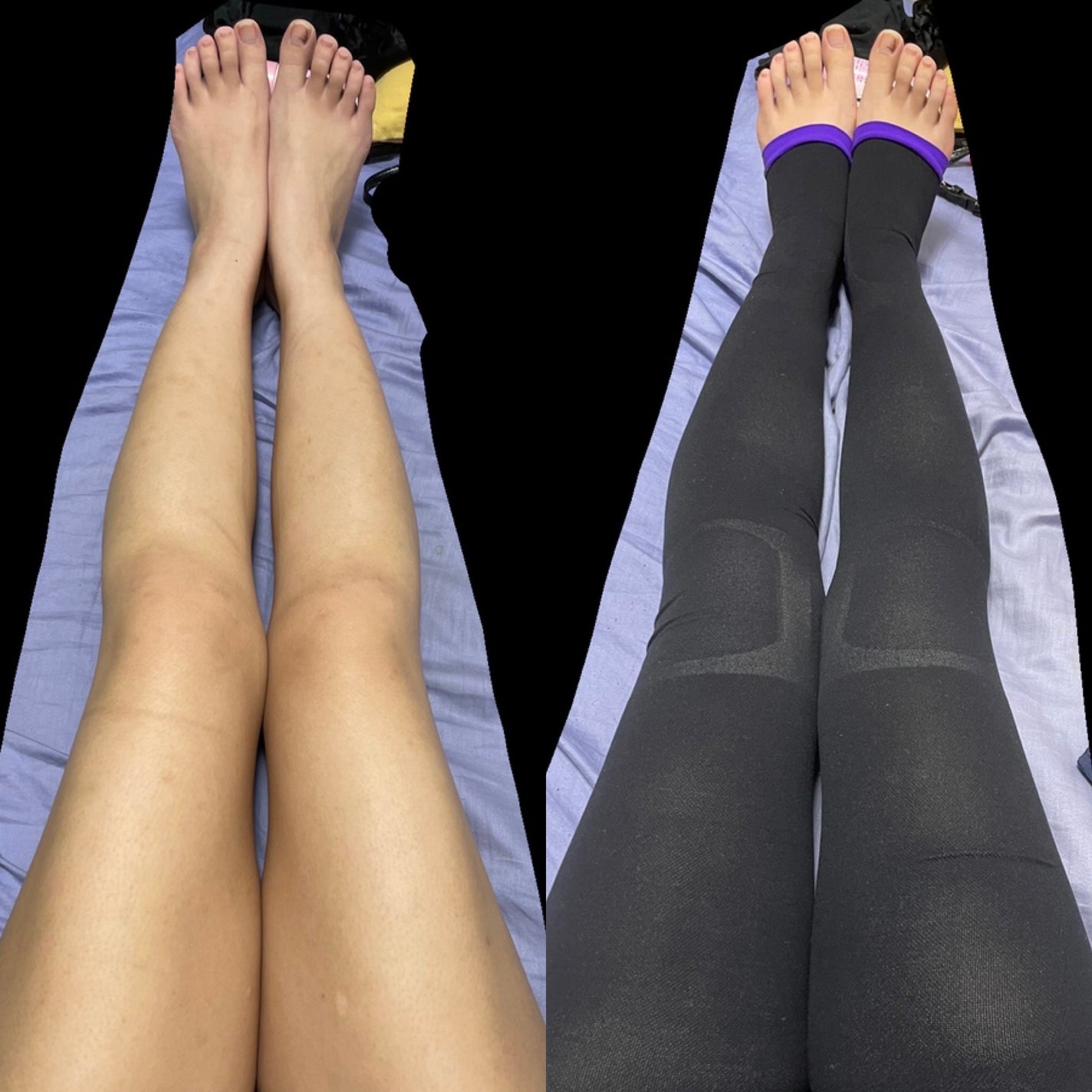 寝ながらメディキュット フルレッグ EX/メディキュット/着圧ソックス・レギンスを使ったクチコミ(2枚目)