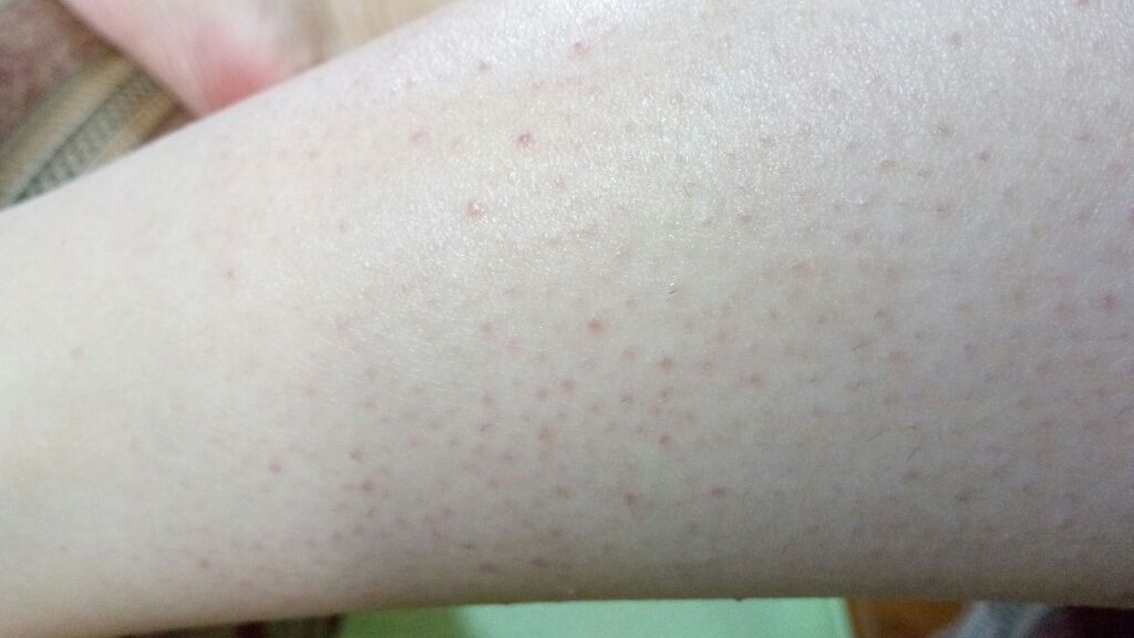 ニベア ヴァセリンのボディクリームを使った口コミ 誰か助けてください By あゆにゆ 脂性肌 10代後半 Lips ニベア ヴァセリンのボディクリームを使った口コミ 誰か助けてください By あゆにゆ 脂性肌 10代後半 Lips