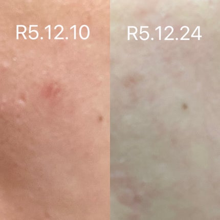 VT シカ VCマスク/VT/シートマスク・パックを使ったクチコミ(4枚目)