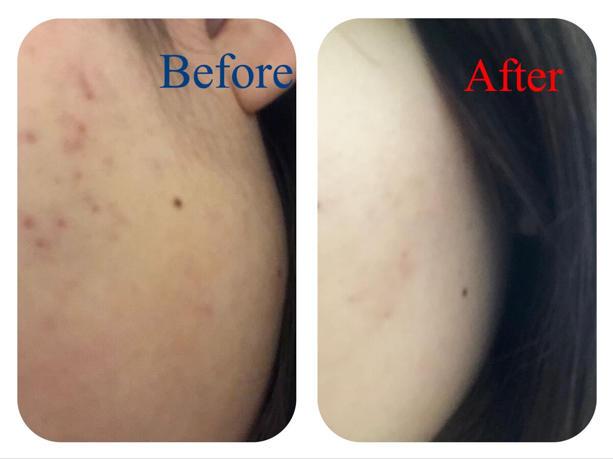 チョコラBBスパークリング/チョコラBB/美容ドリンクを使ったクチコミ（2枚目）