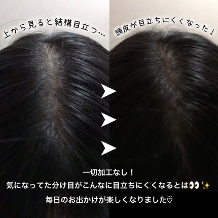 コスメジタン モンジューヌ ヘアマジカパウダー/シーヴァ/頭皮ケアを使ったクチコミ(3枚目)