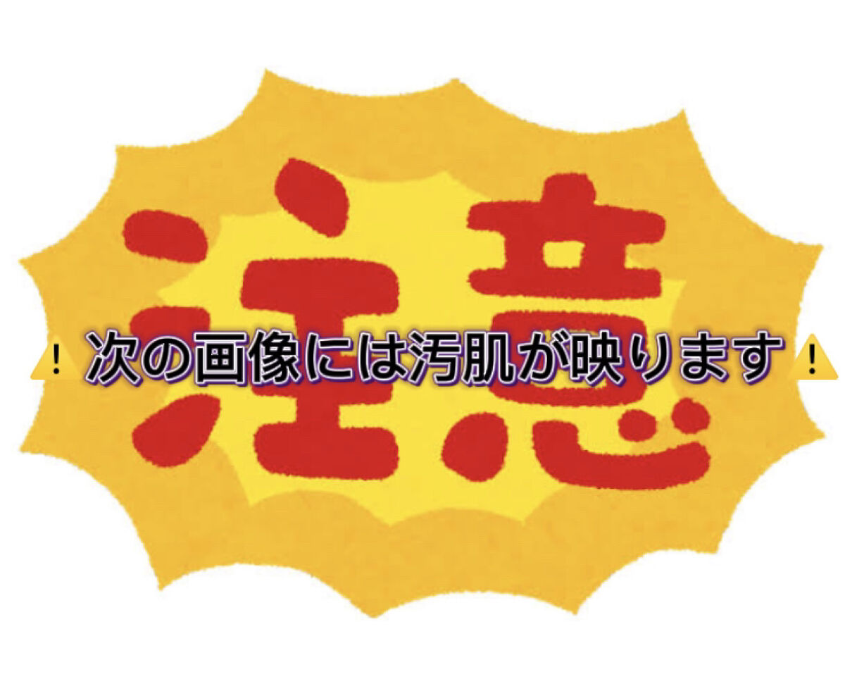 薬用しみ対策 美白化粧水/メラノCC/化粧水を使ったクチコミ（2枚目）