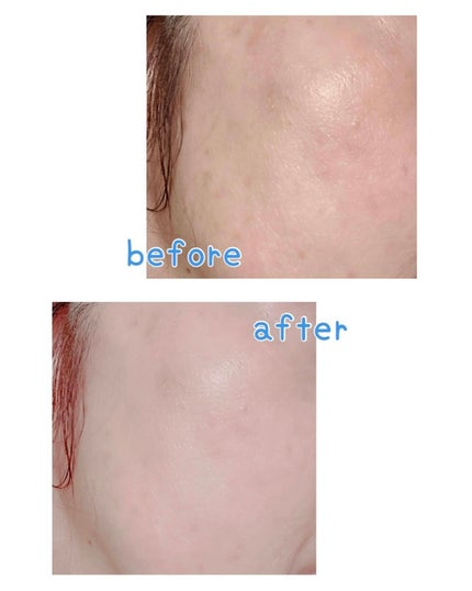 パーフェクティングフィッティング フルカバレッジクッション/LILIBETH/クッションファンデーションを使ったクチコミ(5枚目)