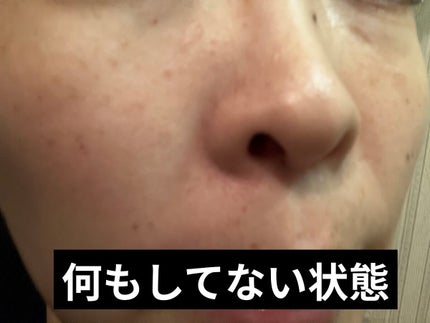 オバジC 酵素洗顔パウダー/オバジ/洗顔パウダーを使ったクチコミ(7枚目)