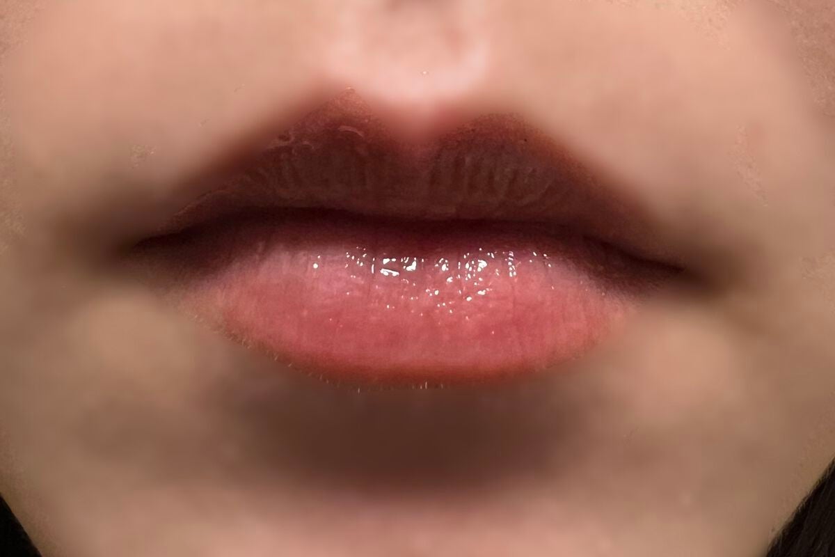 MAAs リップセラム/Dr. Choi's Solution/リップ美容液を使ったクチコミ(1枚目)