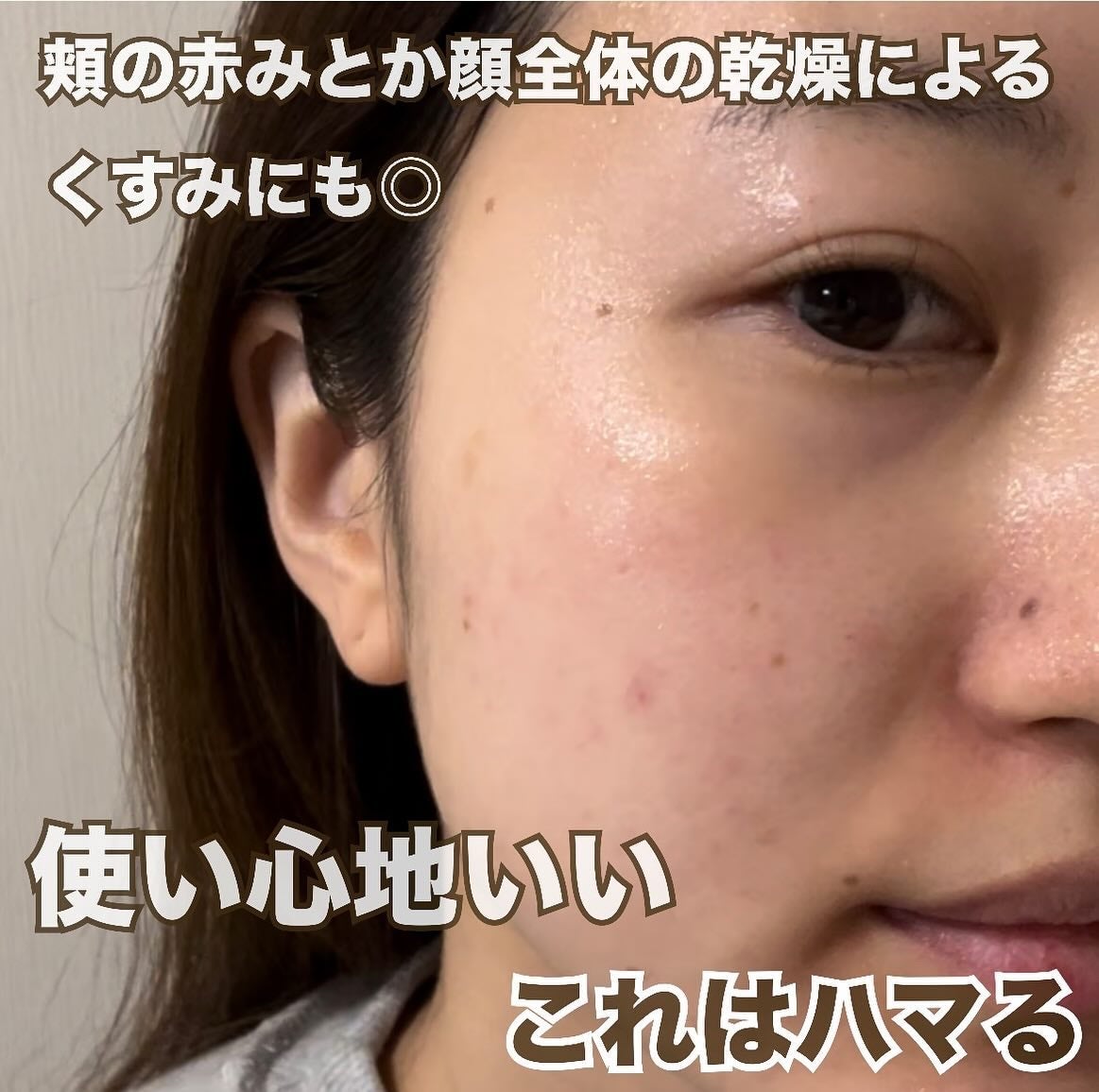 イージーチョップバンドマスク ユースシェーパー/lalachuu/シートマスク・パックを使ったクチコミ(4枚目)