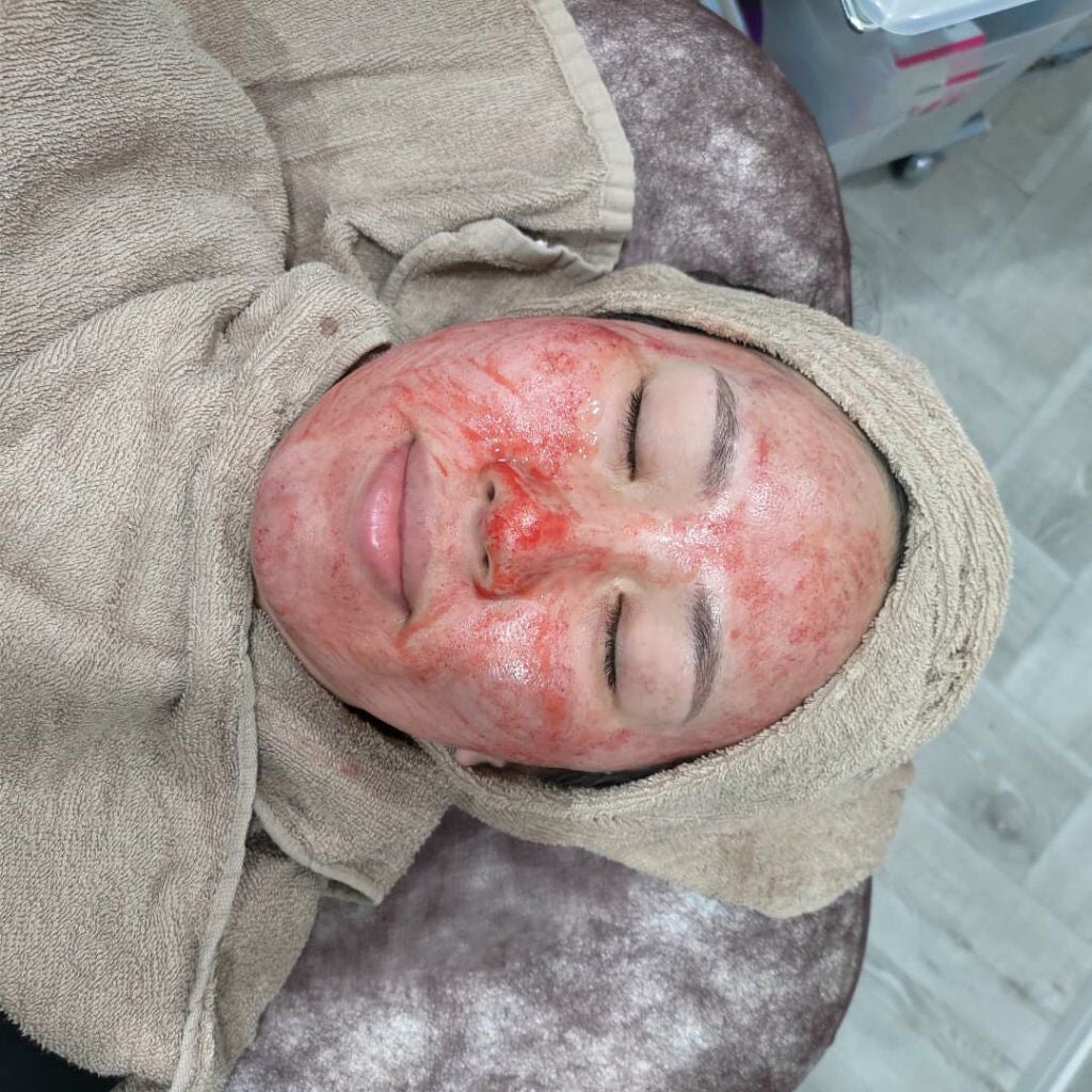 ᎮꭿꮪꮪꭵFꮮꭴꮢꭿ on LIPS 「ダーマペンの経過報告&備忘録📝🩸🤕最後の写真、施術中の流血画像..」(4枚目)