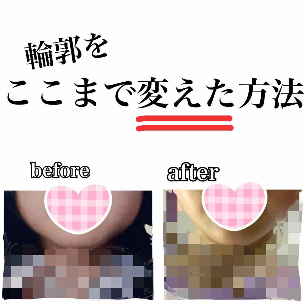 ニベアクリーム/ニベア/ボディクリームを使ったクチコミ（1枚目）