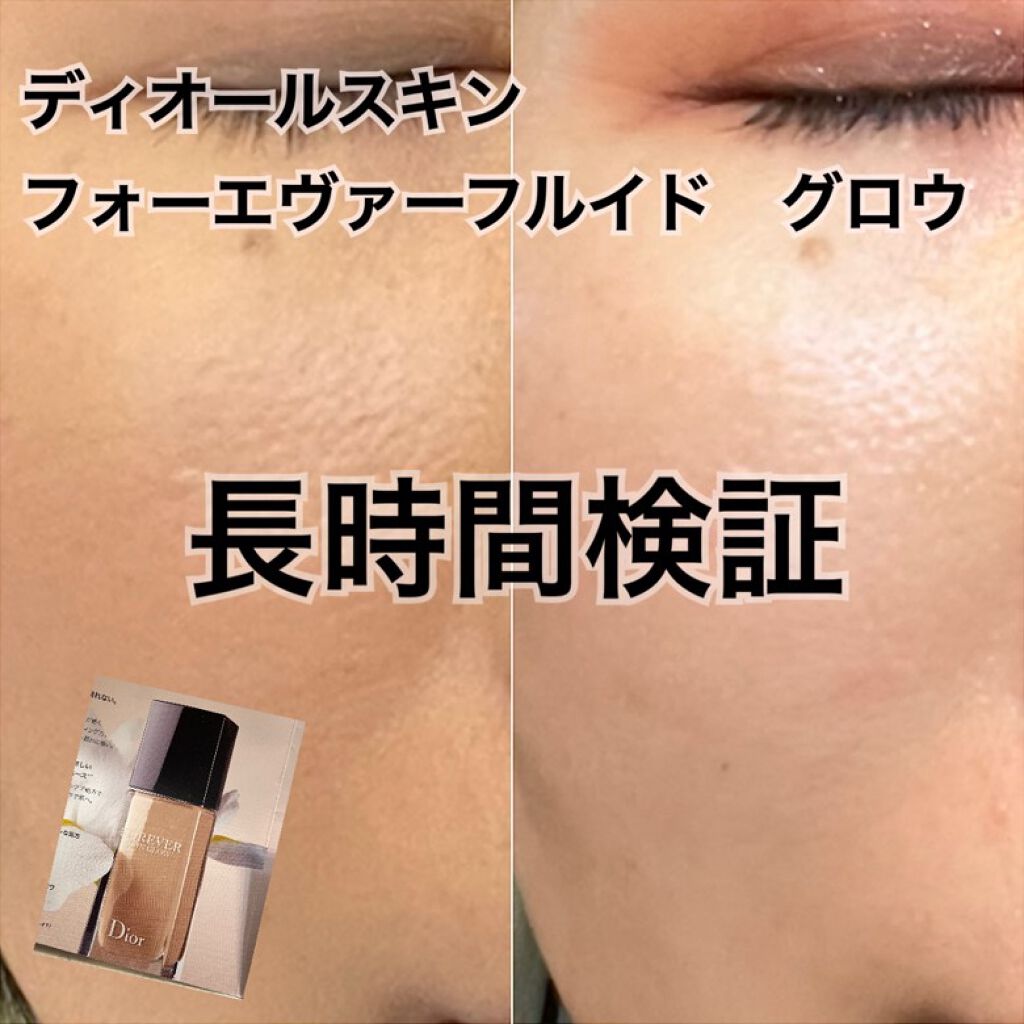 ディオールスキン フォーエヴァー フルイド グロウ/Dior/リキッドファンデーションを使ったクチコミ（1枚目）