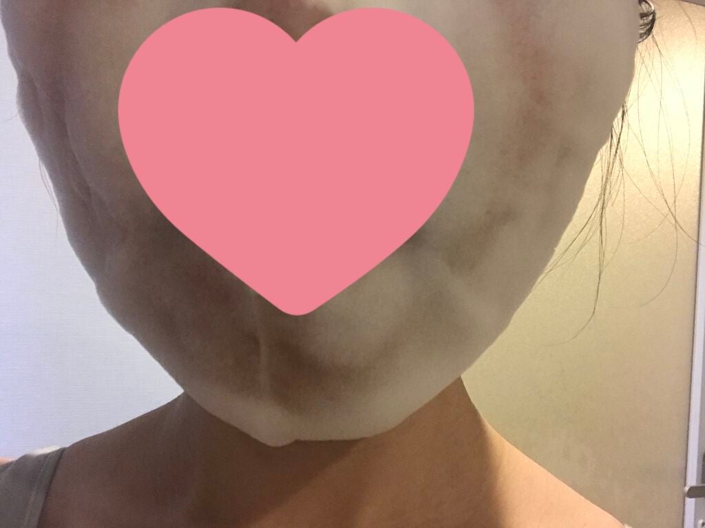 ホワイト もこもこ白泡マスク/リッツ/洗い流すパック・マスクを使ったクチコミ(4枚目)