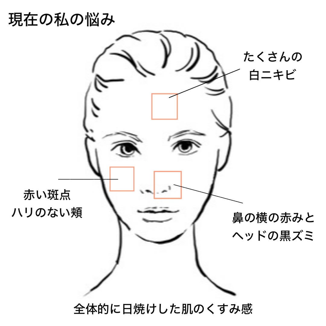 ミミ on LIPS 「【私の肌は1週間でどこまで変われるのか】夏のスキンケアをサボっ..」(2枚目)