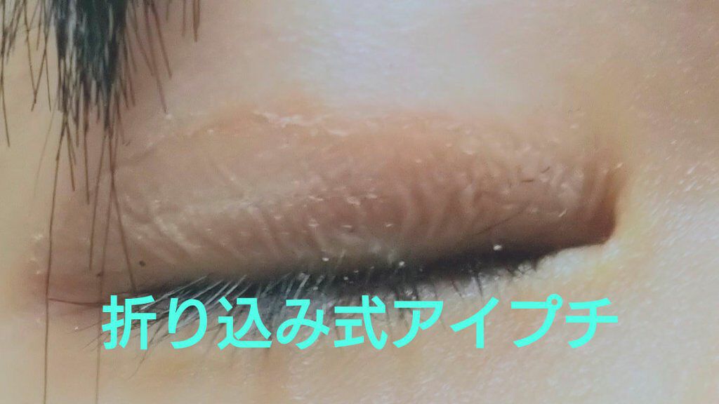 ナイトアイボーテ/StreeTrend/二重まぶた用アイテムを使ったクチコミ（3枚目）