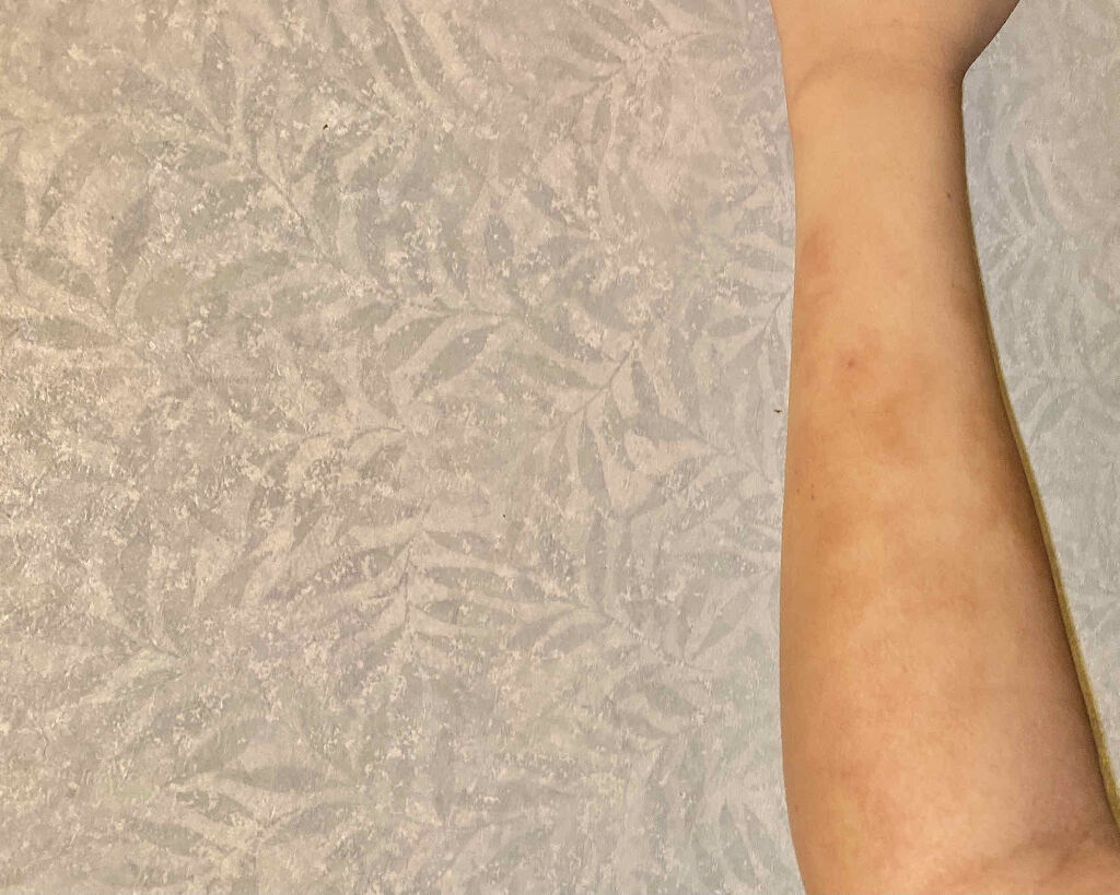 フレッシュリージュースドビタミンドロップ(35ml)/Klairs/美容液を使ったクチコミ（2枚目）