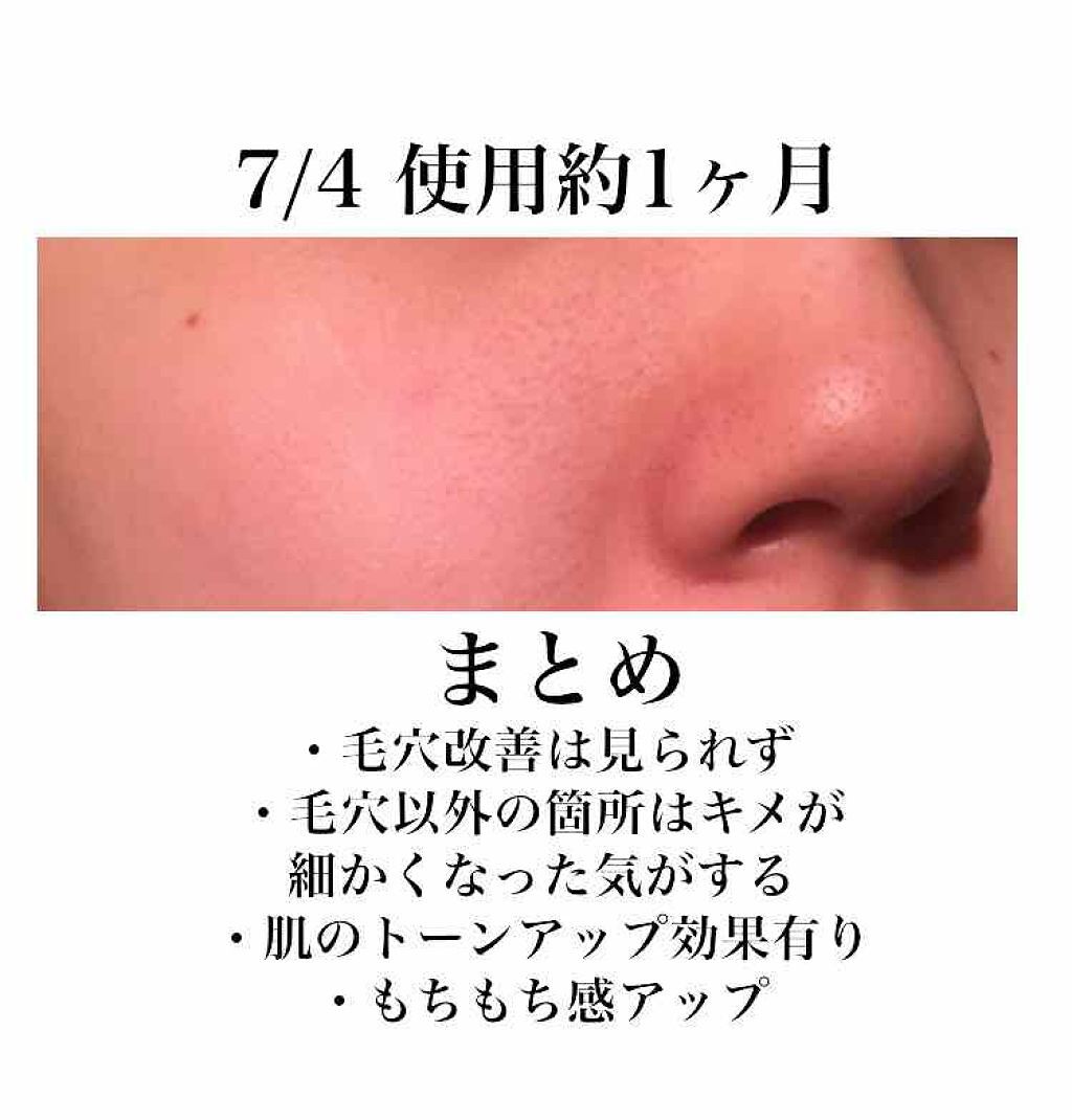 スパ・エ・メール ファンゴ シーバムクリア パック/Prédia/シートマスク・パックを使ったクチコミ（3枚目）