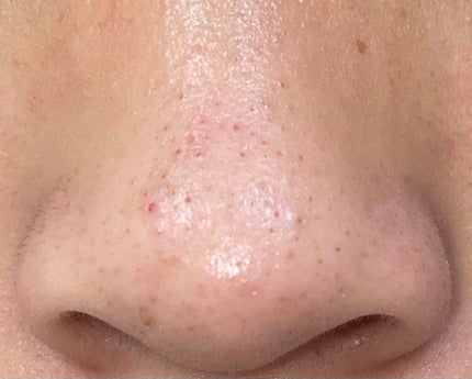 クレンジングバーム/ink./クレンジングバームを使ったクチコミ(1枚目)