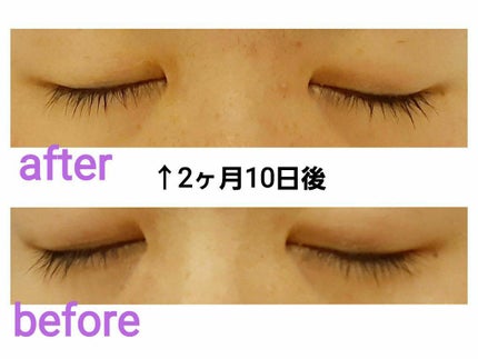 スカルプD ボーテ ピュアフリーアイラッシュセラム/アンファー(スカルプD)/まつげ美容液を使ったクチコミ(1枚目)