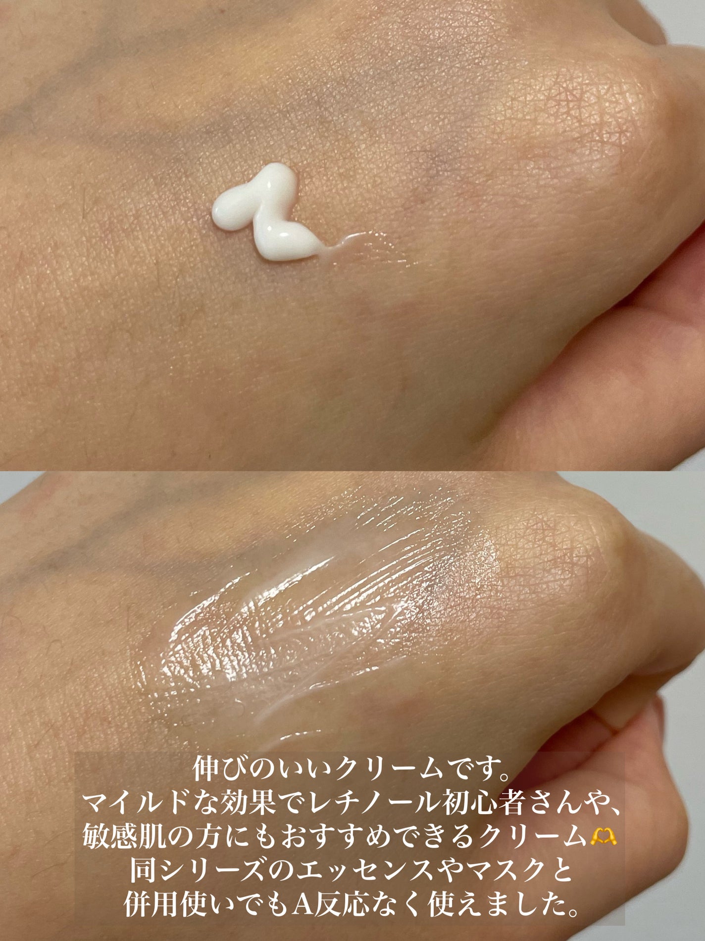 シカレチA クリーム0.05/VT/フェイスクリームを使ったクチコミ(2枚目)