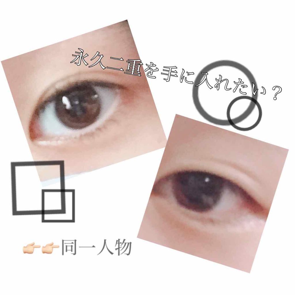 のび〜る アイテープ 両面テープタイプ/DAISO/二重まぶた用アイテムを使ったクチコミ（1枚目）