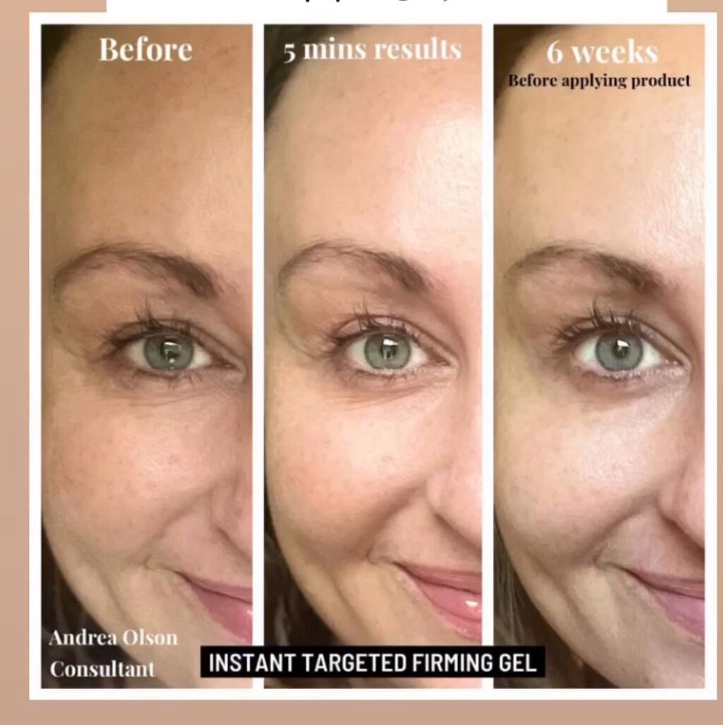 試してみた】インスタント ターゲティッド ファーミング ジェル