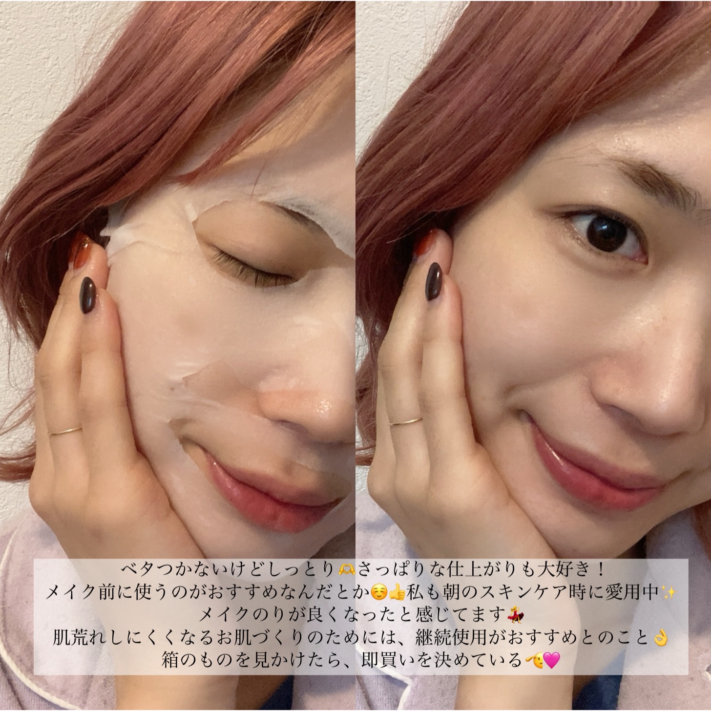 ルルルン ハイドラ AZ マスク/ルルルン/シートマスク・パックを使ったクチコミ（3枚目）