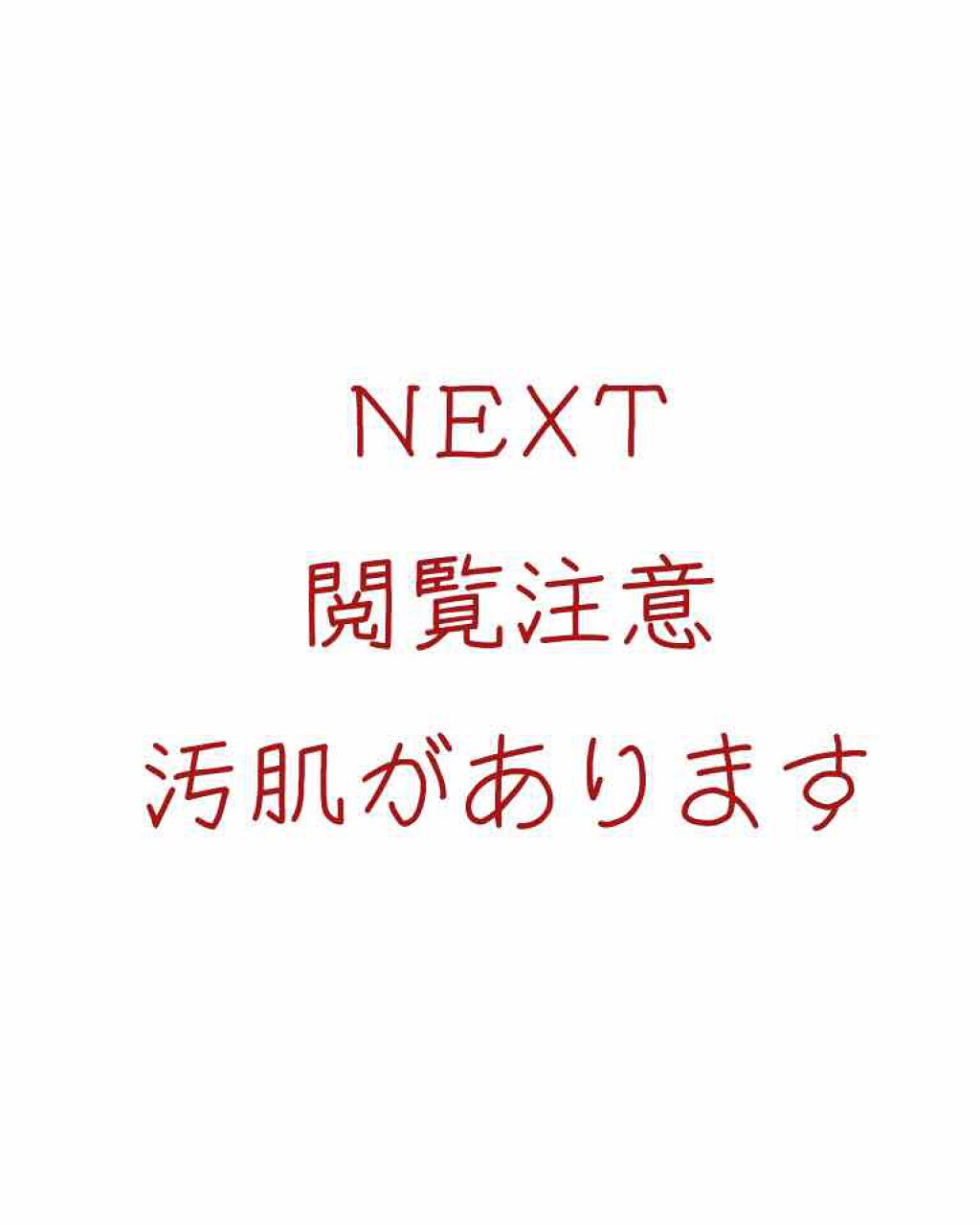 ACC パッチ/ETUDE/シートマスク・パックを使ったクチコミ（3枚目）