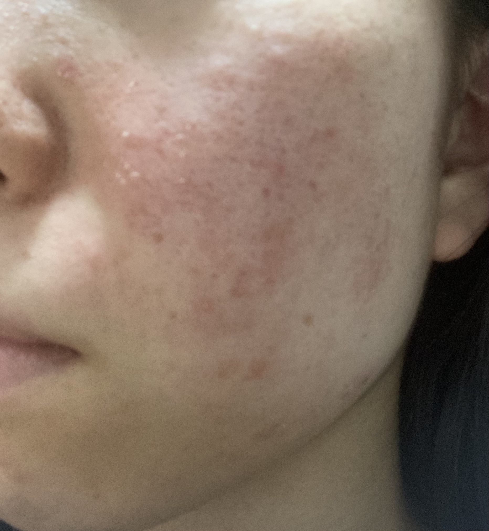 ACアクティブ クレンジングリキッド/NOV/クレンジングウォーターを使ったクチコミ（2枚目）