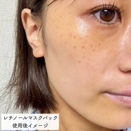 ピンクティーツリーマスクパック/APLIN/シートマスク・パックを使ったクチコミ(7枚目)