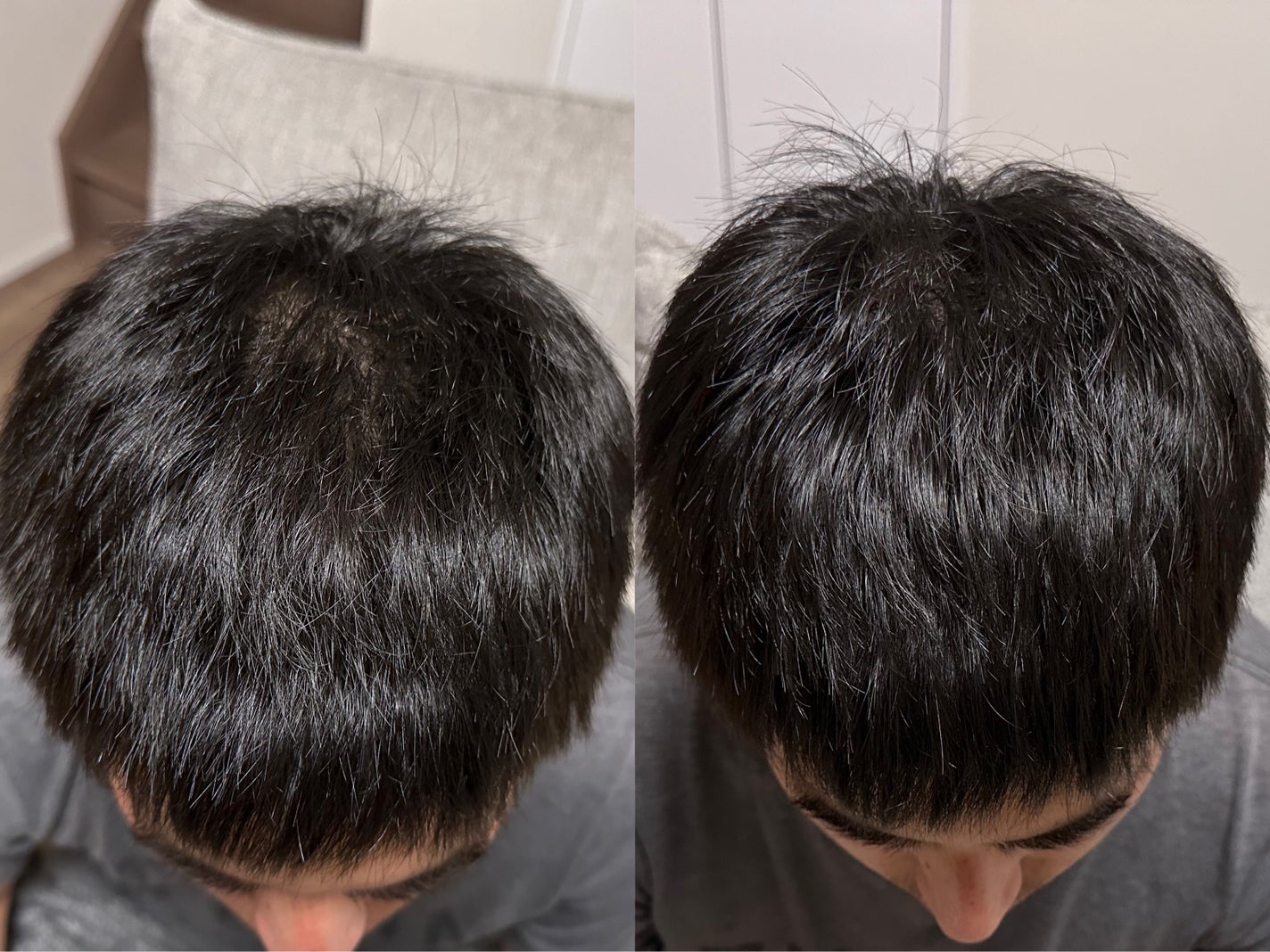 SonoRepro/アンファー(スカルプD)/ヘアケアグッズを使ったクチコミ(3枚目)