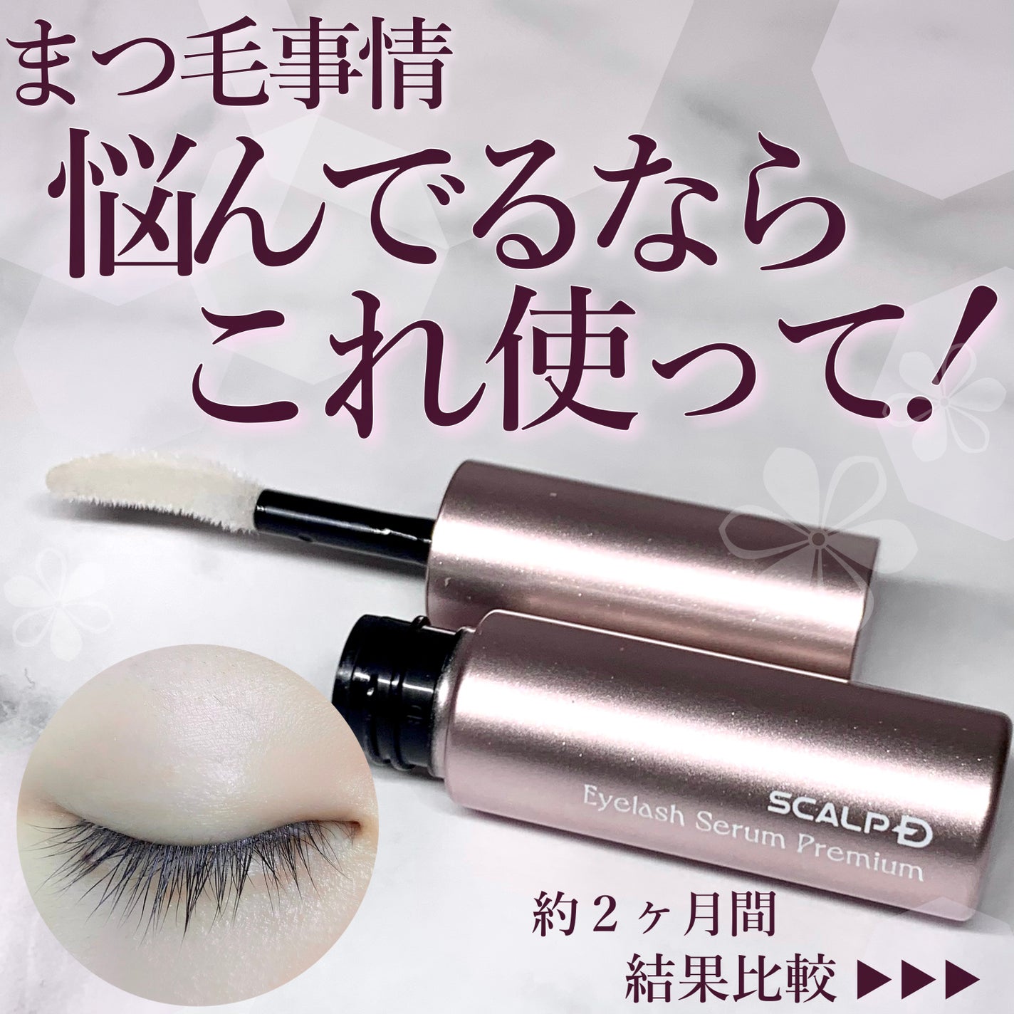 スカルプD アイラッシュセラム プレミアム/アンファー(スカルプD)/まつげ美容液を使ったクチコミ(1枚目)