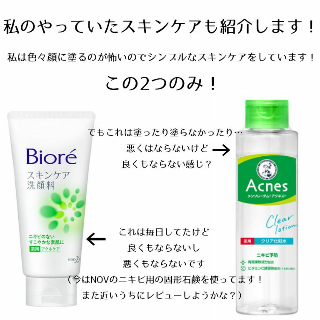 ノブ Ａ アクネソープ/NOV/洗顔石鹸を使ったクチコミ（3枚目）