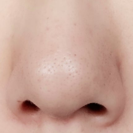 ソフティモ 薬用ホワイト クレンジングウォッシュ/ソフティモ/洗顔フォームを使ったクチコミ(8枚目)