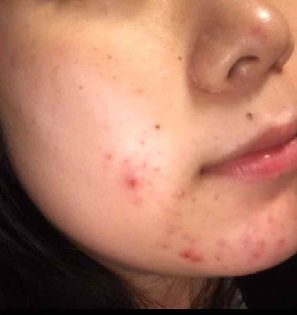 を使ったクチコミ(1枚目)