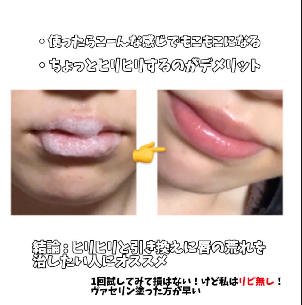 ブビブビ バブルリップスクラブ/unpa/リップスクラブを使ったクチコミ(2枚目)