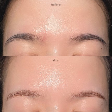 ジョレン クリーム ブリーチ/ジョレンジャパン/ムダ毛ケアを使ったクチコミ(5枚目)