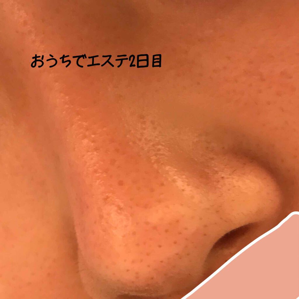 おうちdeエステ 肌をなめらかにする マッサージ洗顔ジェル/ビオレ/その他洗顔料を使ったクチコミ(3枚目)