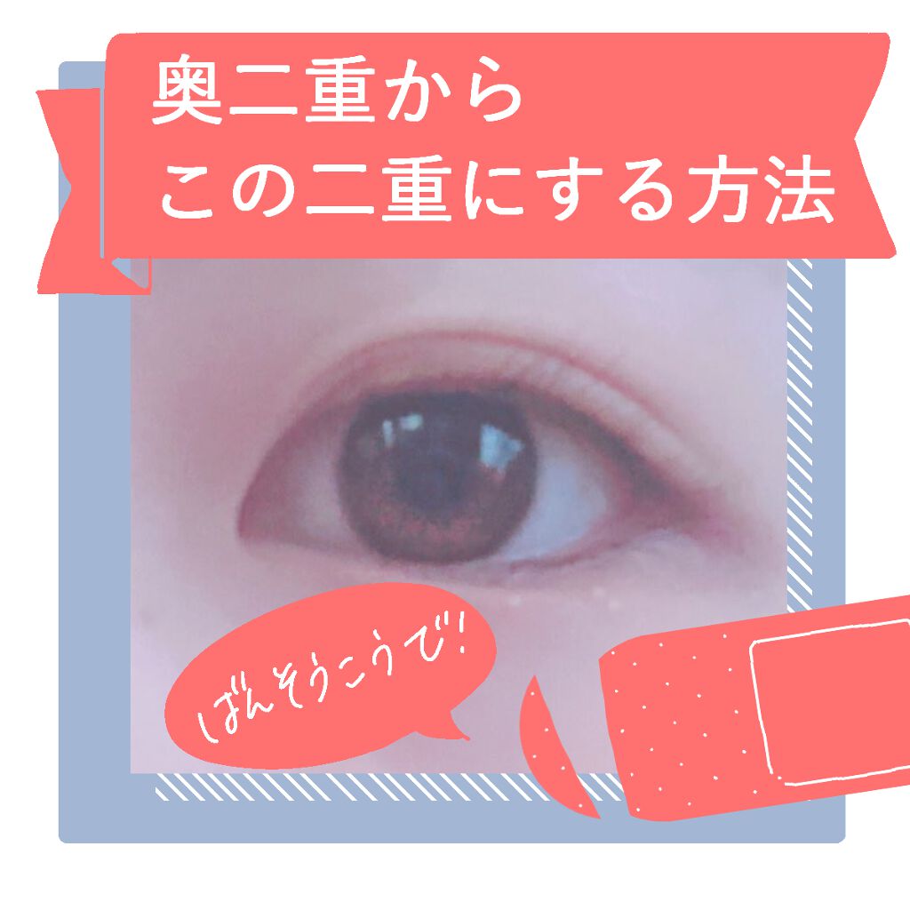 救急ばんそうこう/ドン・キホーテ/その他を使ったクチコミ(1枚目)