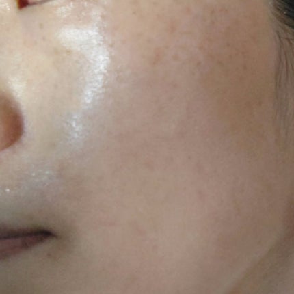 イドラクラリティ 薬用 トリートメント エッセンス ウォーター/DECORTÉ/化粧水を使ったクチコミ(5枚目)