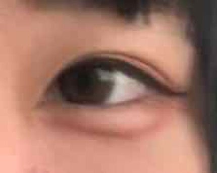 のびーるアイテープ(絆創膏タイプ、レギュラー)/DAISO/二重まぶた用アイテムを使ったクチコミ(2枚目)