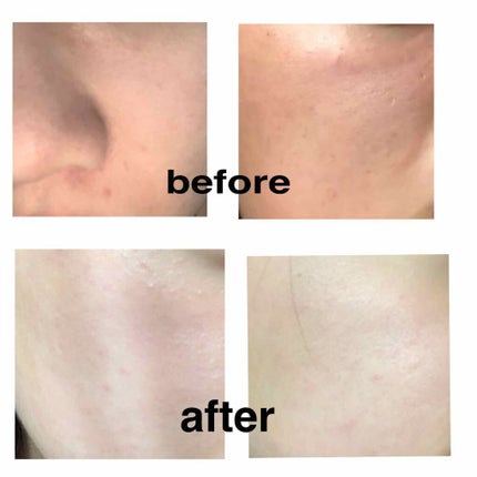 お米のパック/毛穴撫子/洗い流すパック・マスクを使ったクチコミ(2枚目)