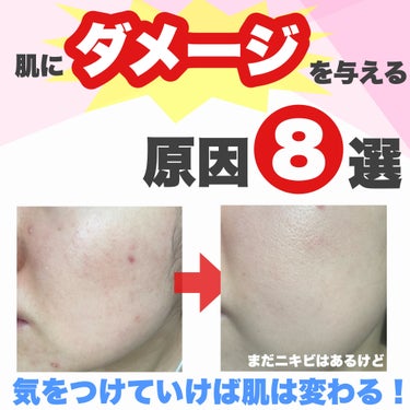 紗々🌸フォロバ100(投稿ある方) on LIPS 「日常に肌ダメージの原因が潜んでる！！でも対処すれば何の問題もな..」（1枚目）