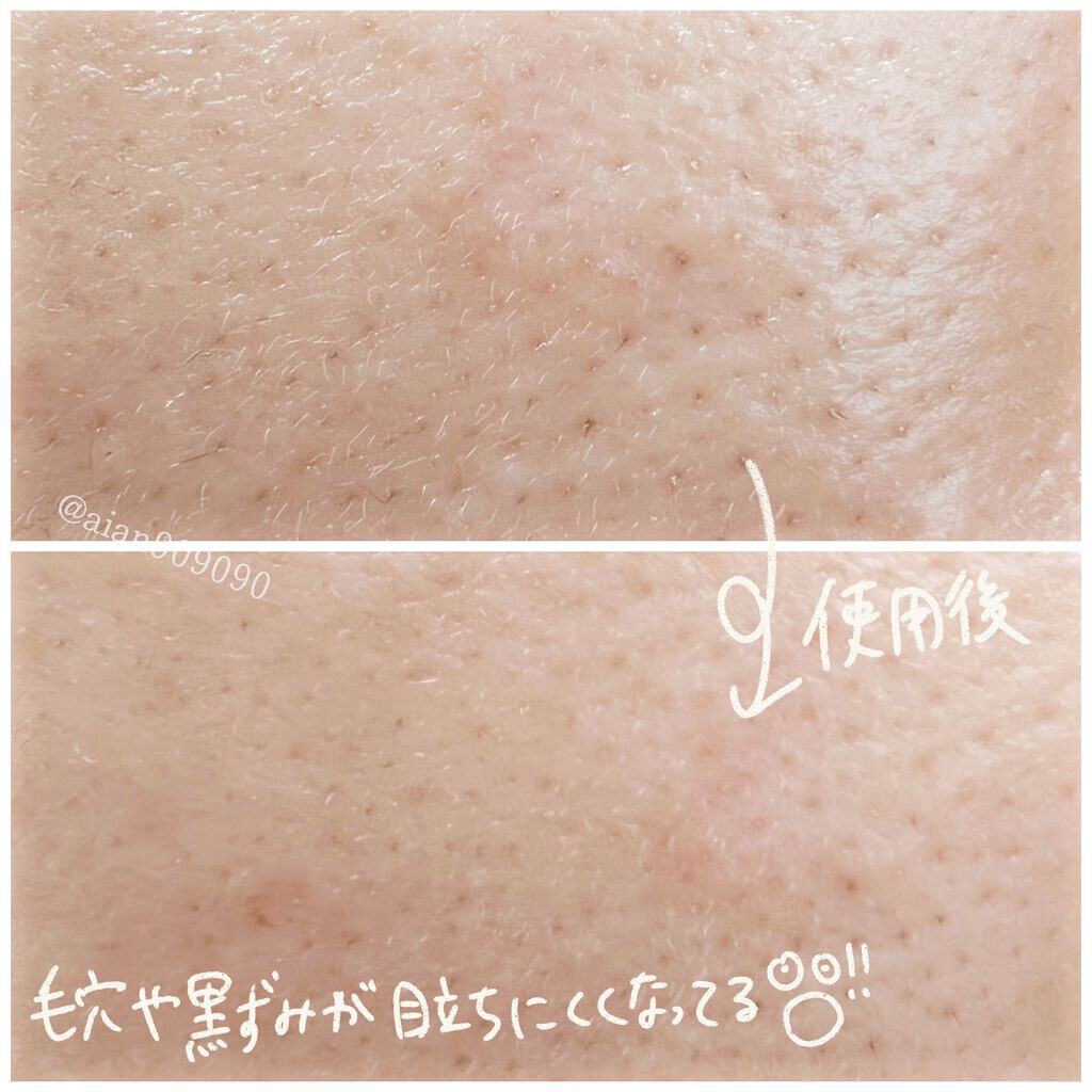 デュオメン ザ ウォッシュバーム/DUO/その他洗顔料を使ったクチコミ(5枚目)