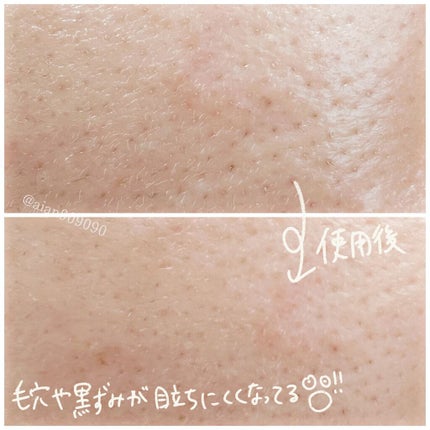 デュオメン ザ ウォッシュバーム/DUO/その他洗顔料を使ったクチコミ(5枚目)