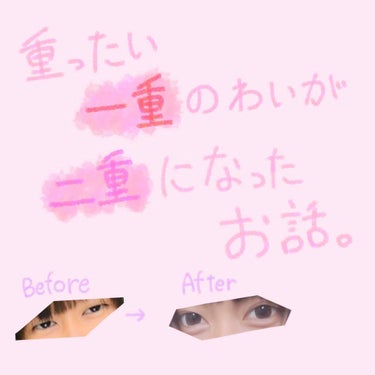 りん 🐟🌹 on LIPS 「🌷めちゃくそ重たい一重のわいが二重になったお話。💗（マッサージ..」（1枚目）