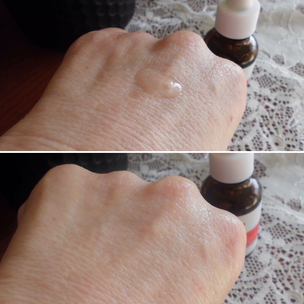 スーパー毛穴ピールセラム/ラボラボ/美容液を使ったクチコミ（1枚目）