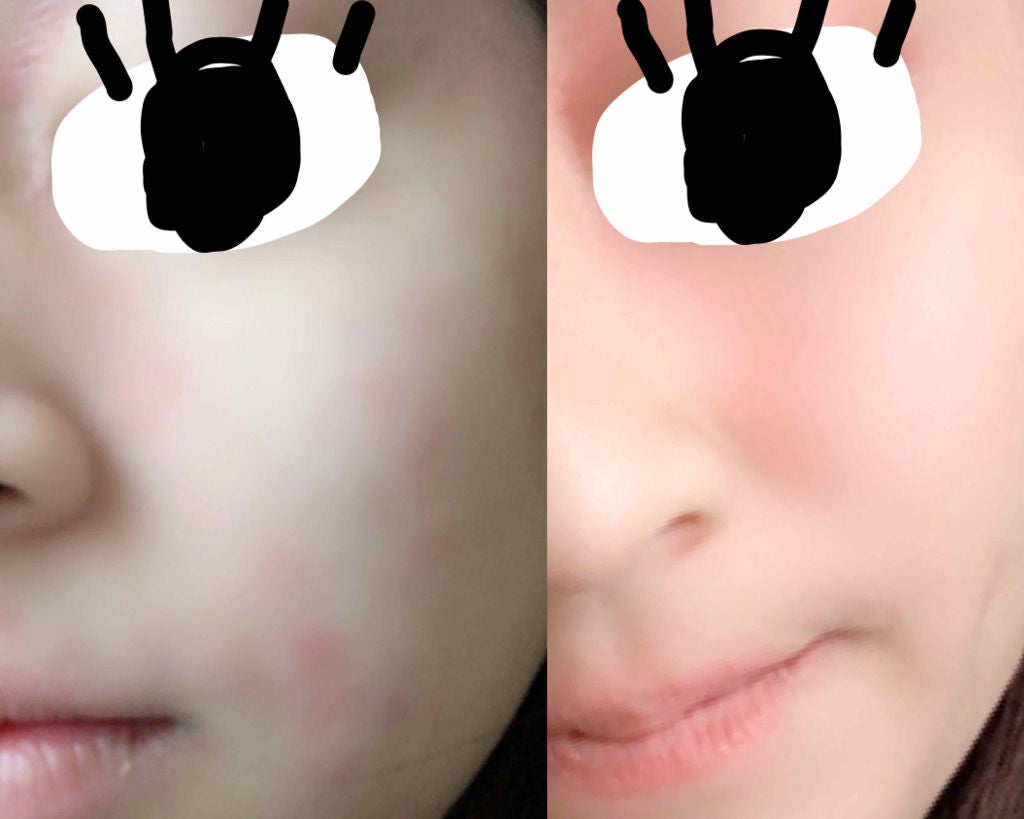 サンシビオ エイチツーオー D/ビオデルマ/クレンジングウォーターを使ったクチコミ(3枚目)