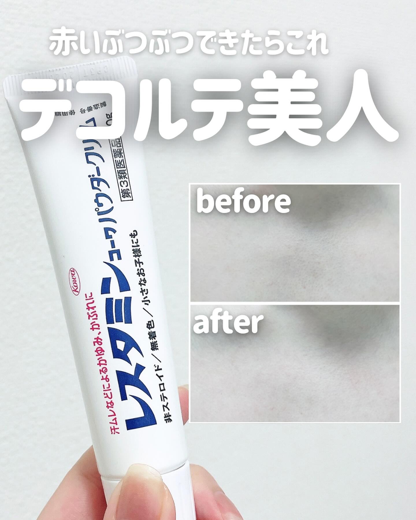 レスタミンコーワパウダークリーム（医薬品）/コーワ/その他を使ったクチコミ（1枚目）