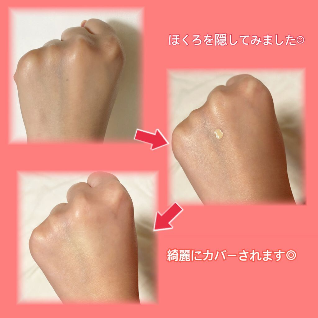 レッドコンシーラー/MEDICUBE/リキッドコンシーラーを使ったクチコミ（2枚目）