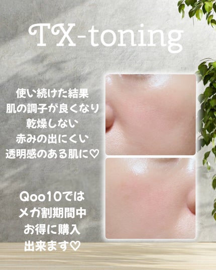 リードルショット300/VT/美容液を使ったクチコミ(4枚目)