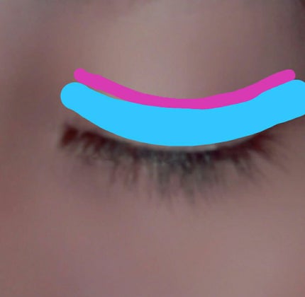 アイビューティー フィクサー WP/アストレア ヴィルゴ/二重まぶた用アイテムを使ったクチコミ(4枚目)